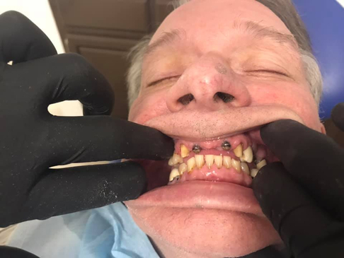 Slider image (2) Kool Dental